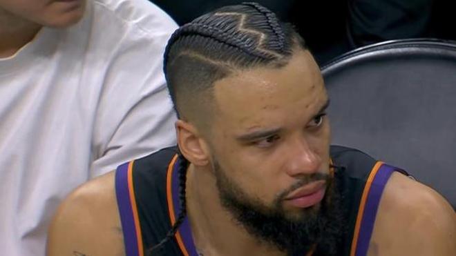 火箭力克太阳东契奇伤退季后赛前景生变